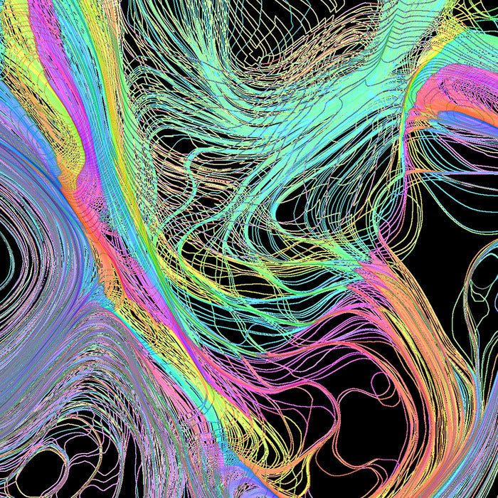 Lupe 2r - 2 - 1, 2019, dye-infused aluminum print, 30 x 30 in. / 76.2 x 76.2 cm.