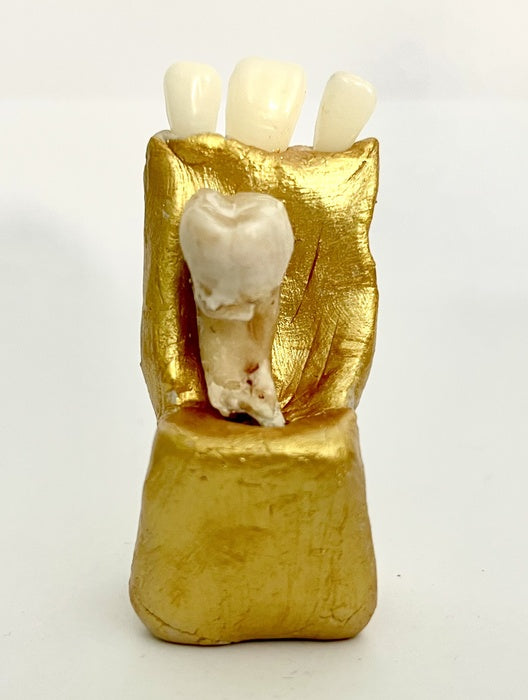 König Arsch von Zahn, 2025, ceramics and teeth, 2.5 x 2.5 in. / 6.35 x 6.35 cm.